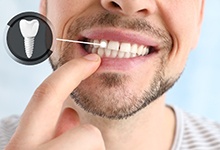 Male patient pointing at his dental implant restoration