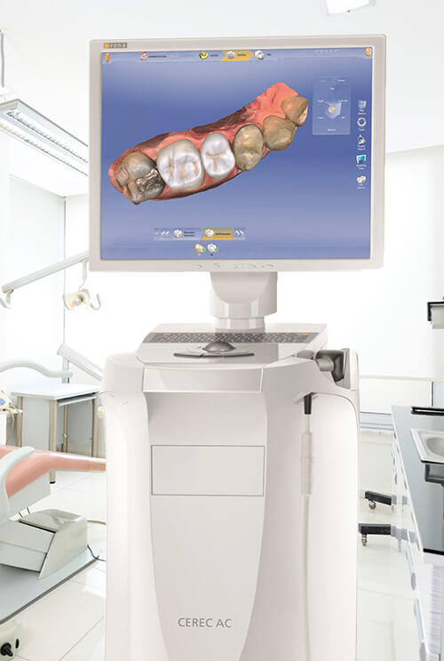 CEREC digital dental restoration design and creation system