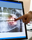 Dentist pointing to advanced dental technology system
