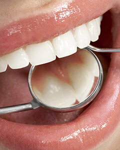 Dentist examining healthy smile after periodontal therapy