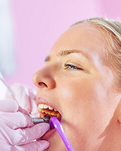 Relaxed patient receiving dental treatment during nitrous oxide sedation dentistry visit