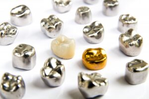 Assortment of different dental crowns.